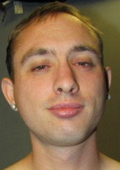 Tyler-Frisella